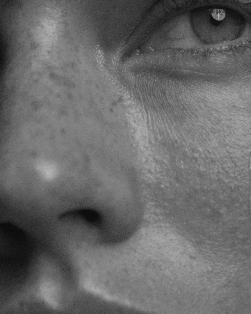 The Delayed Biology of Photoaging